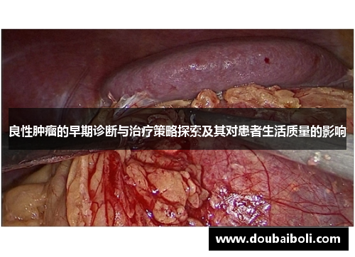 良性肿瘤的早期诊断与治疗策略探索及其对患者生活质量的影响